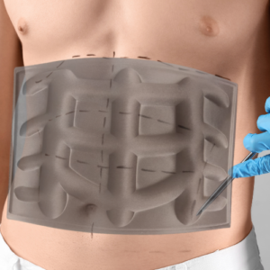 Tabla  Marcador Abdominal Masculino